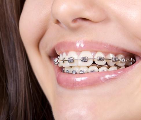 Orthodontics