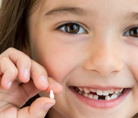 Removal of milk teeth