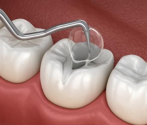 Герметизация