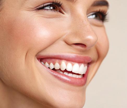 Профессиональное отбеливание